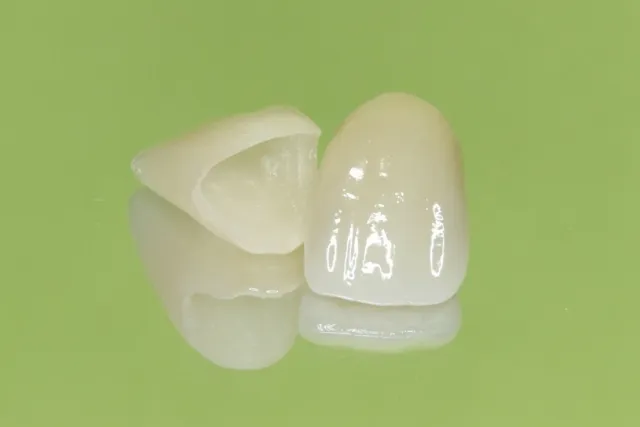 より天然歯に近い審美的な質感をご提供